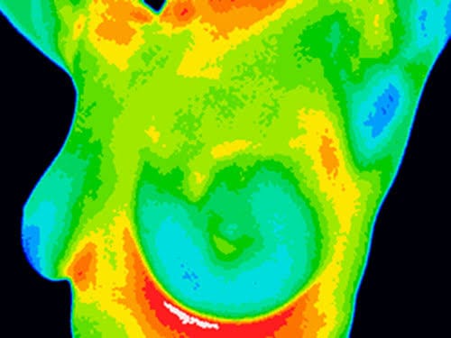 8th September Health Hub - Feed the Soil, Feed the Soul 18 Thermography
