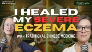imgi 14 f0nCx.OvCc small Healing Eczema Naturally Th